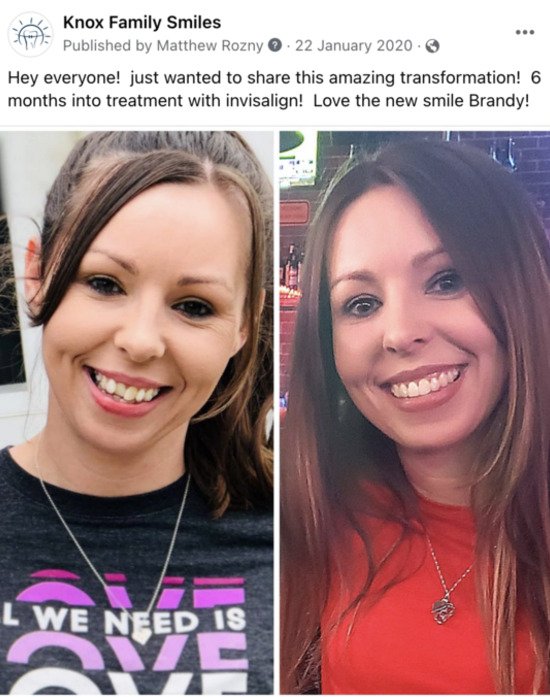 Knox Family Smiles Before and After